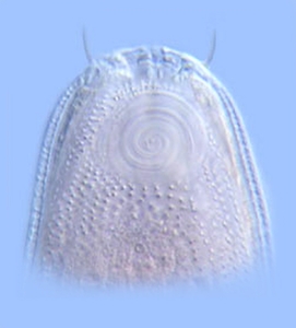 <em>Cheironchus</em> sp. has a large, spiral ampid, a chemosensory structures foud in all nematodes.<br />Photo: W. Duane Hope