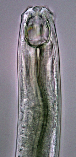 The mouth region of the predatory soil nematode Anatonchus tridentatus.