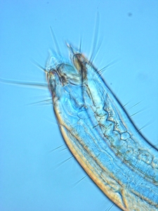 The marine enoplid nematode Epacanthion sp.